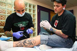 Tattoo Implants