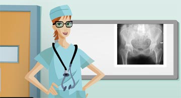 Virtual Hip Surgery